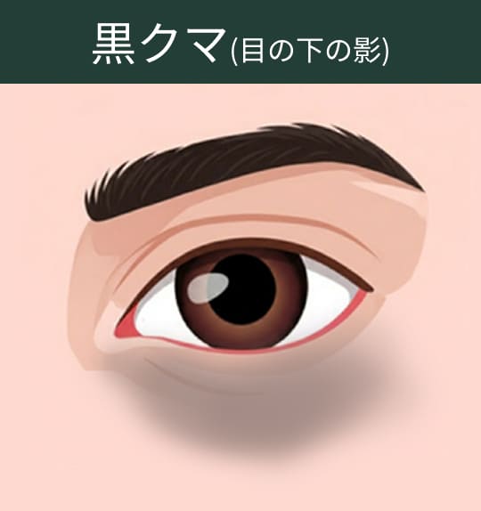 黒クマ(目の下の影)