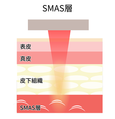 ハイフ：アプローチ層のイメージ