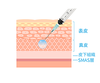 アプローチする層