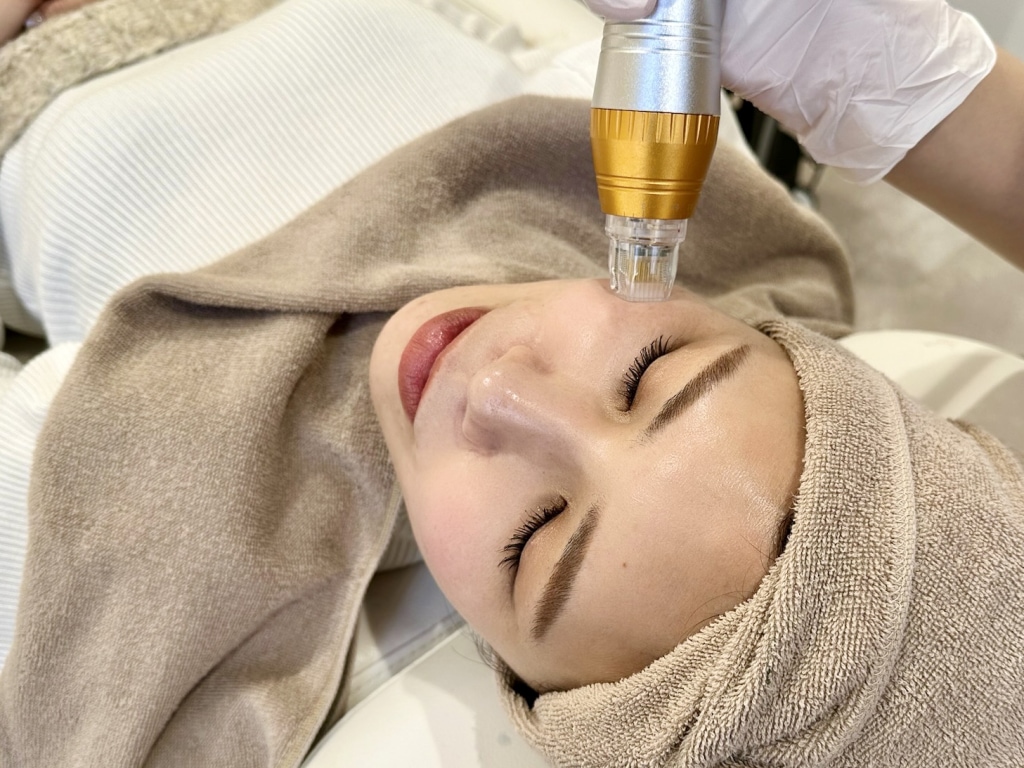 Therma Needle