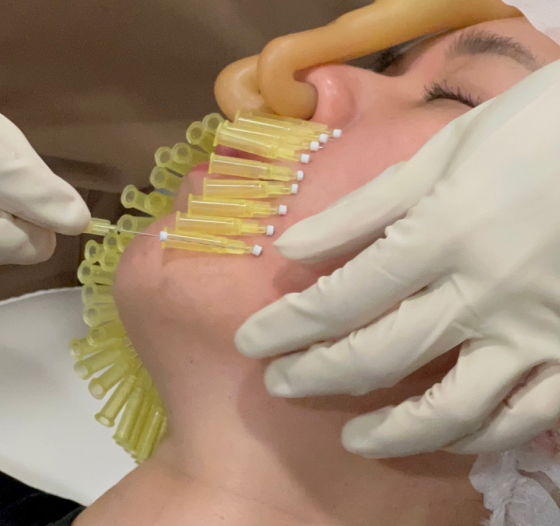 medical treatment (esp. surgical)