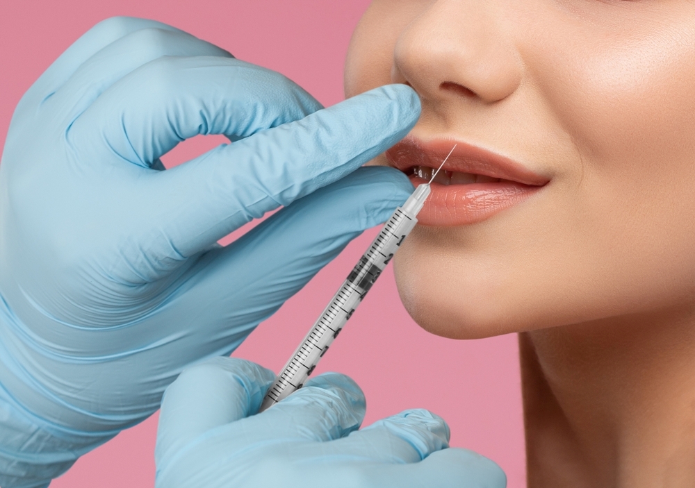 Which clinic in Hiroshima offers hyaluronic acid injections for lips? Introduction of the treatment details.