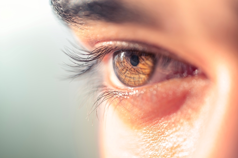 I want to get hyaluronic acid for hollow eyes in Hiroshima! Explanation of treatment time and process