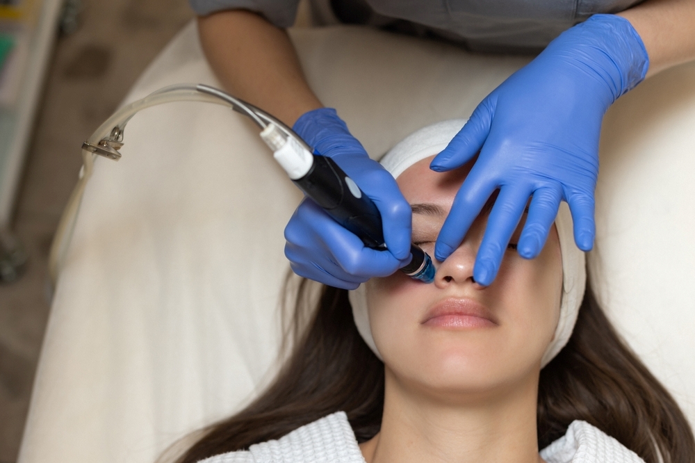 I want to clean pores in Hiroshima! Learn about the effects of advanced medical equipment and self-care methods.