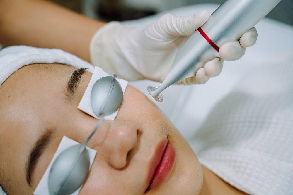 Laser treatment for red face in Hiroshima! Explanation of types of treatment and effects｜Introduction of precautions and key points.