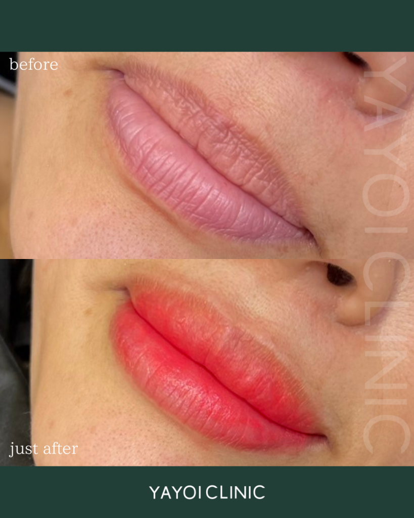 Korean Style Permanent Makeup