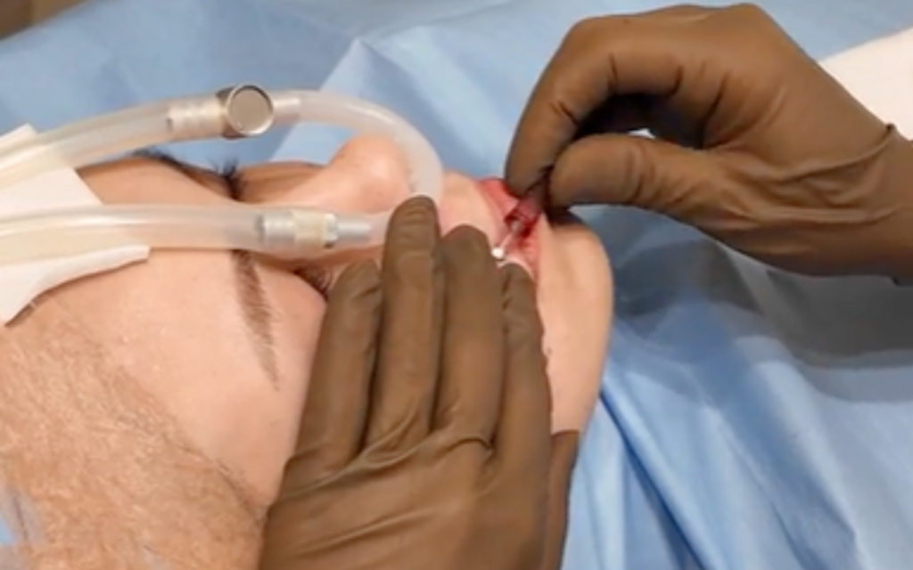 medical treatment (esp. surgical)