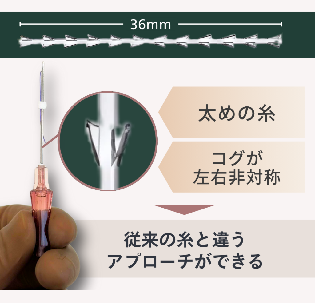 Extendermaster