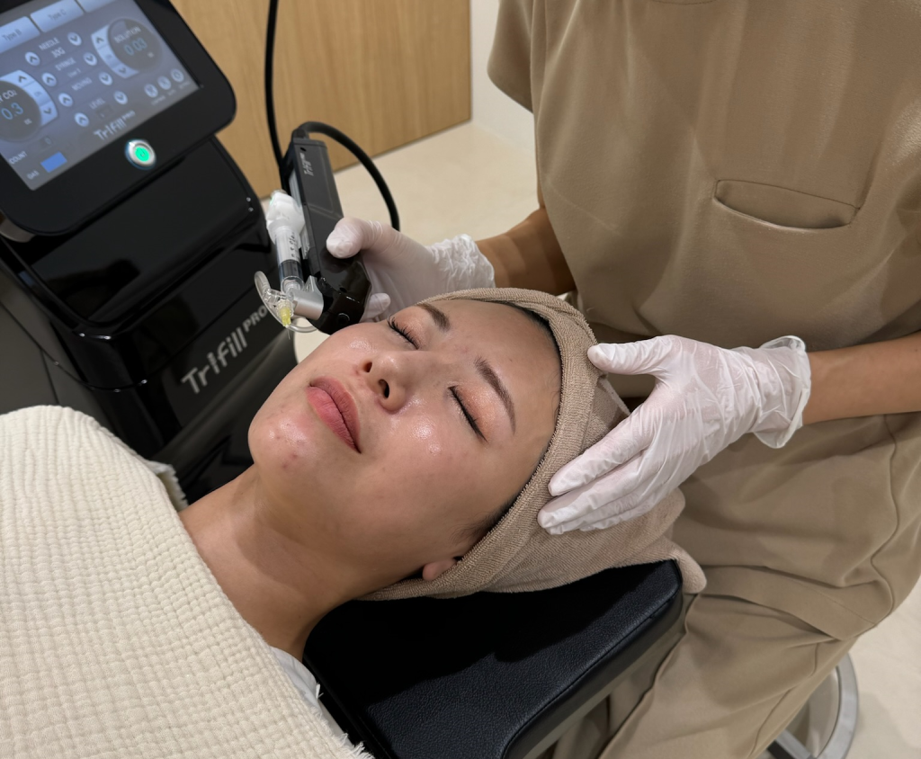 What are acne scar craters? Treatment Methods Thoroughly Explained by Yayoi Clinic in Hiroshima, Japan.