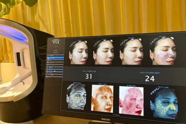 What are acne scar craters? Treatment Methods Thoroughly Explained by Yayoi Clinic in Hiroshima, Japan.