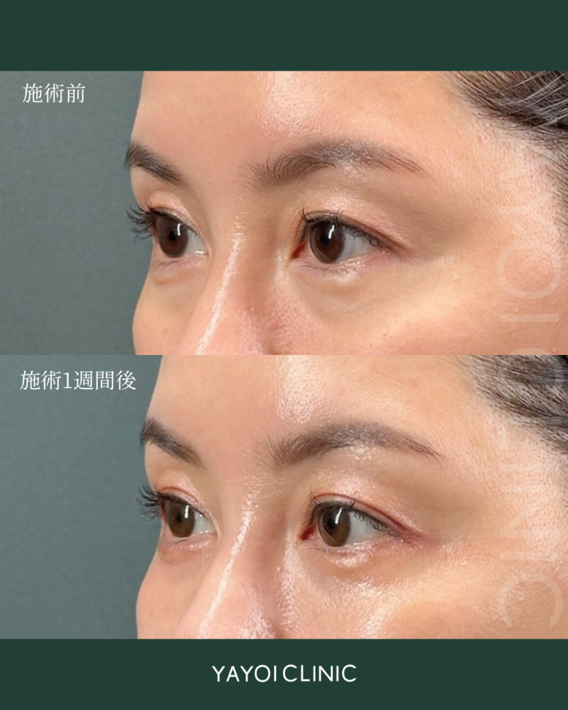 Baby Collagen