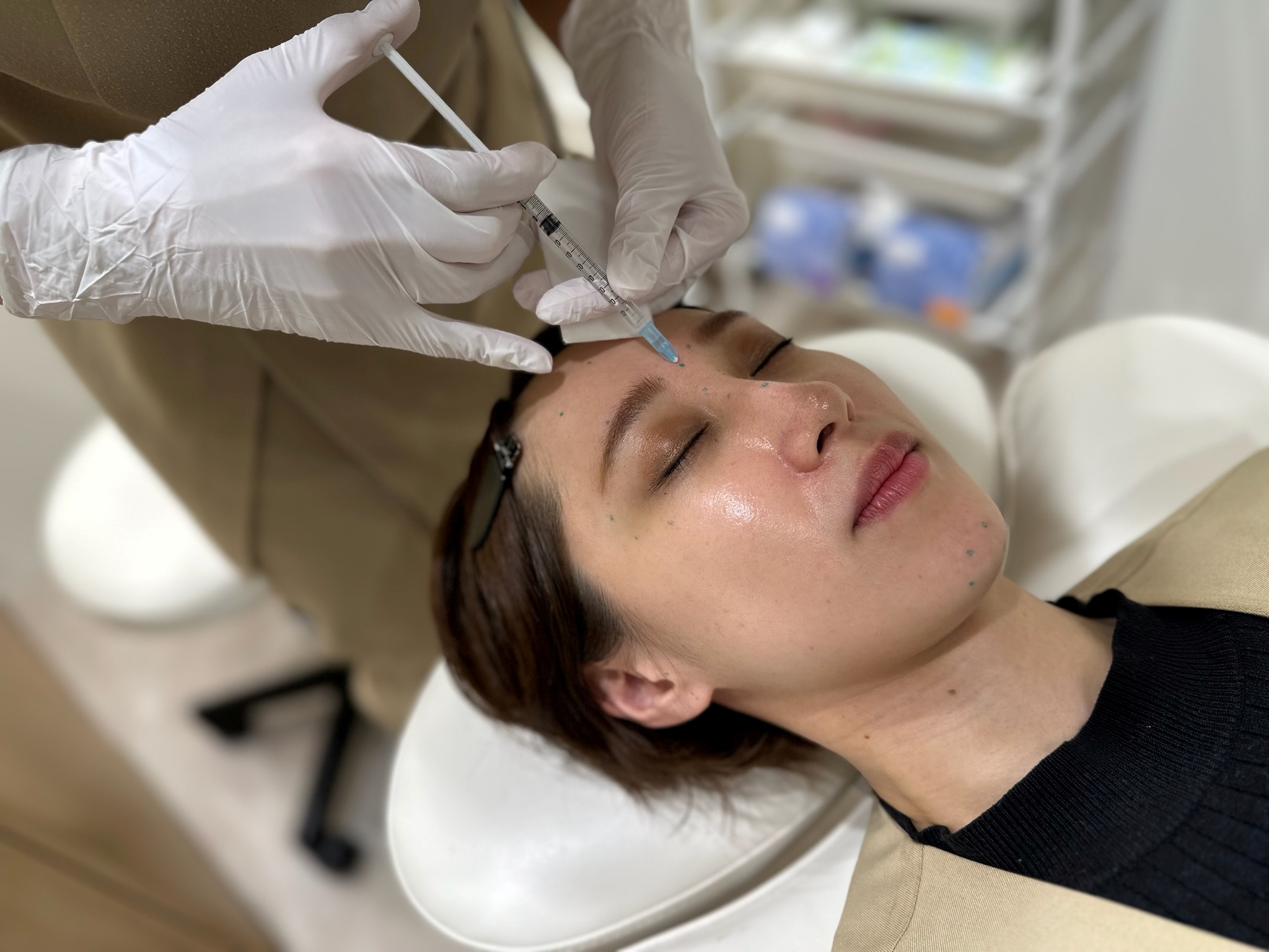 Looking for a cosmetic dermatologist in Hiroshima City? Explanation of recommended procedures and how to choose a clinic.
