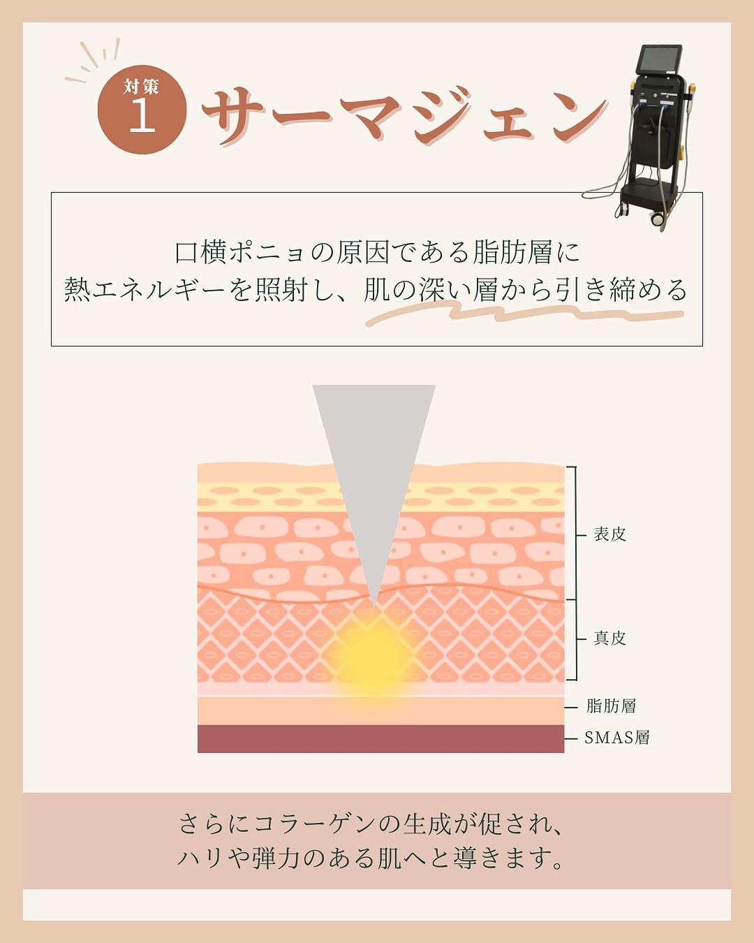 サーマジェンとは？