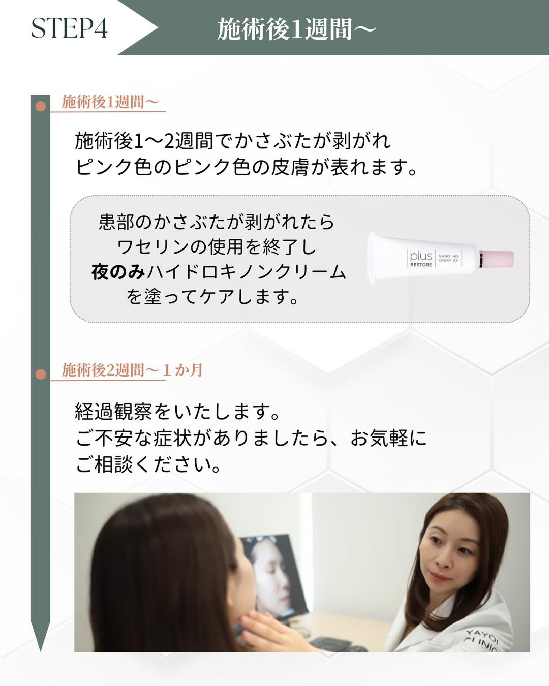 シミ取り後 1週間～
