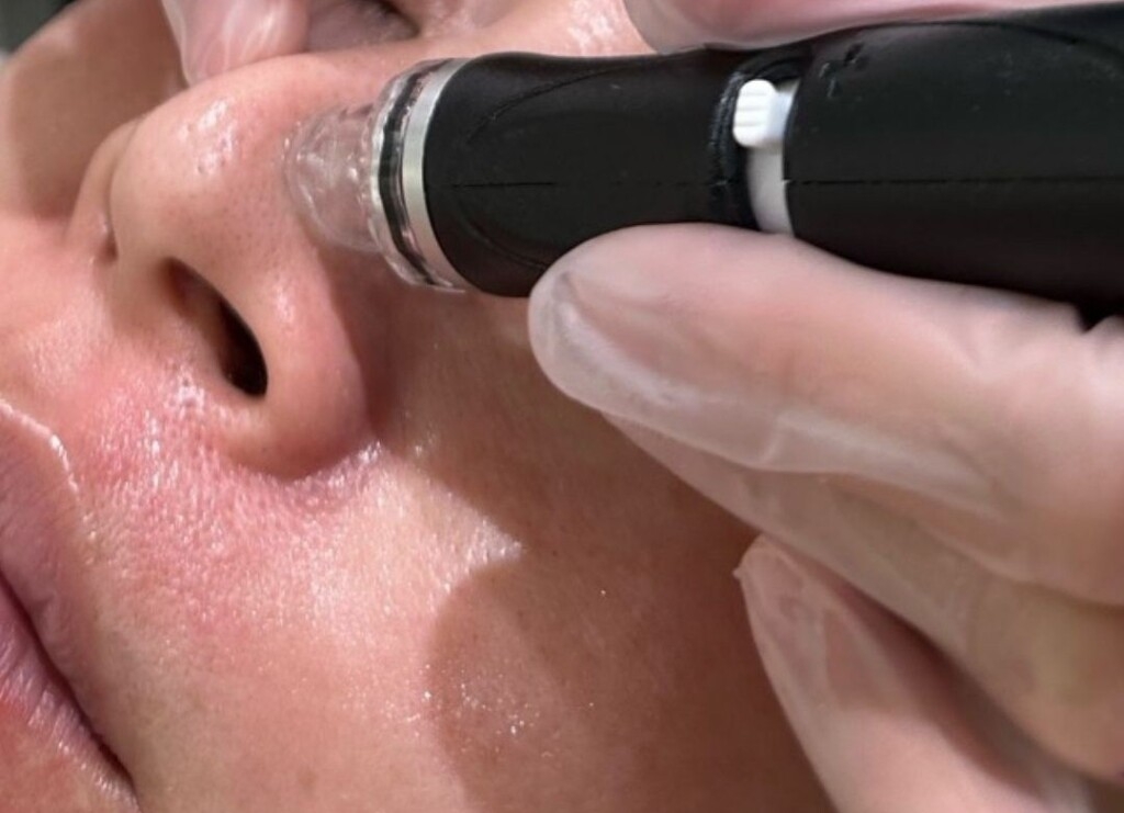 Hiroshima Cosmetic Dermatology approaches men's problems! Explanation of actual conditions and treatment details