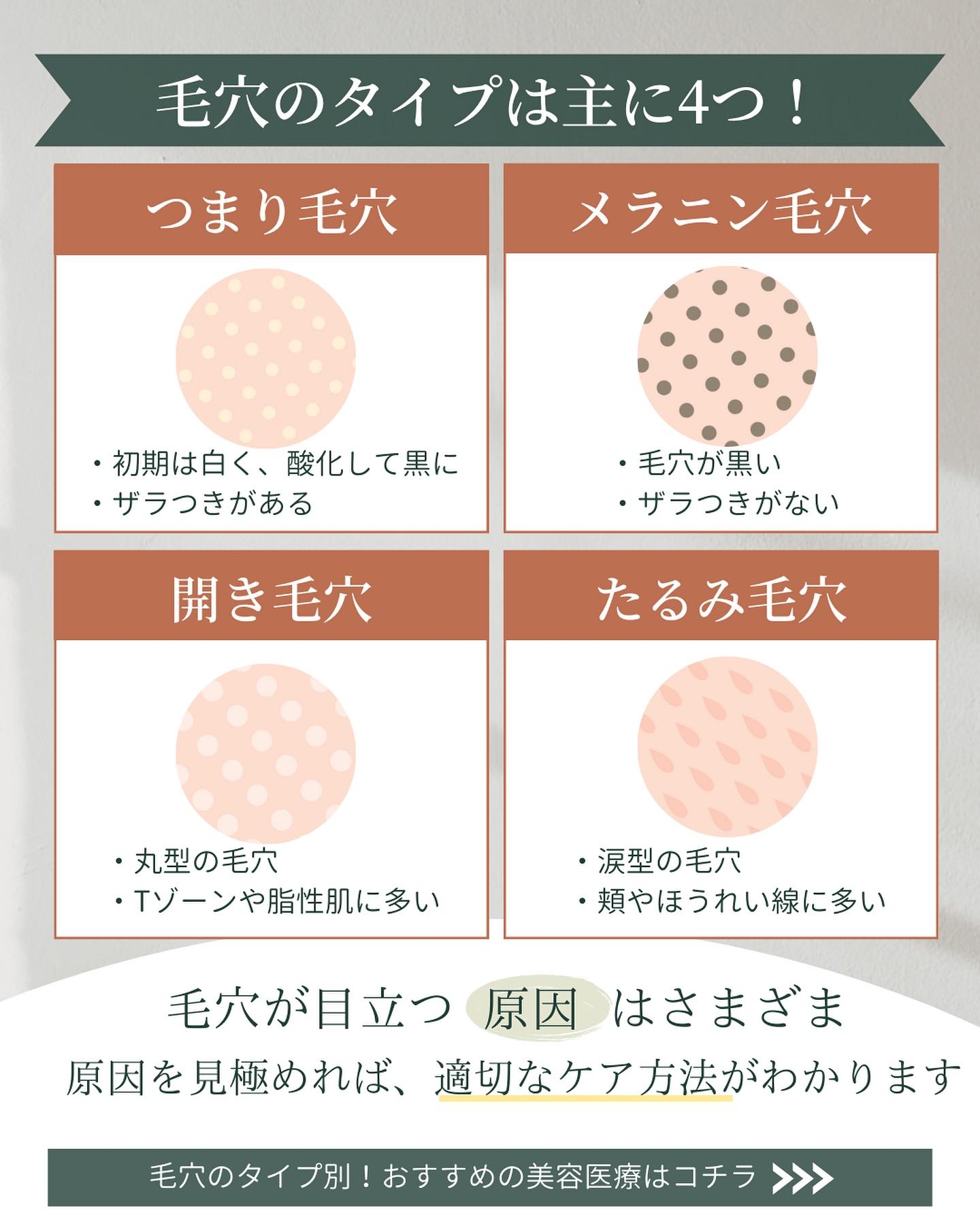 毛穴　種類