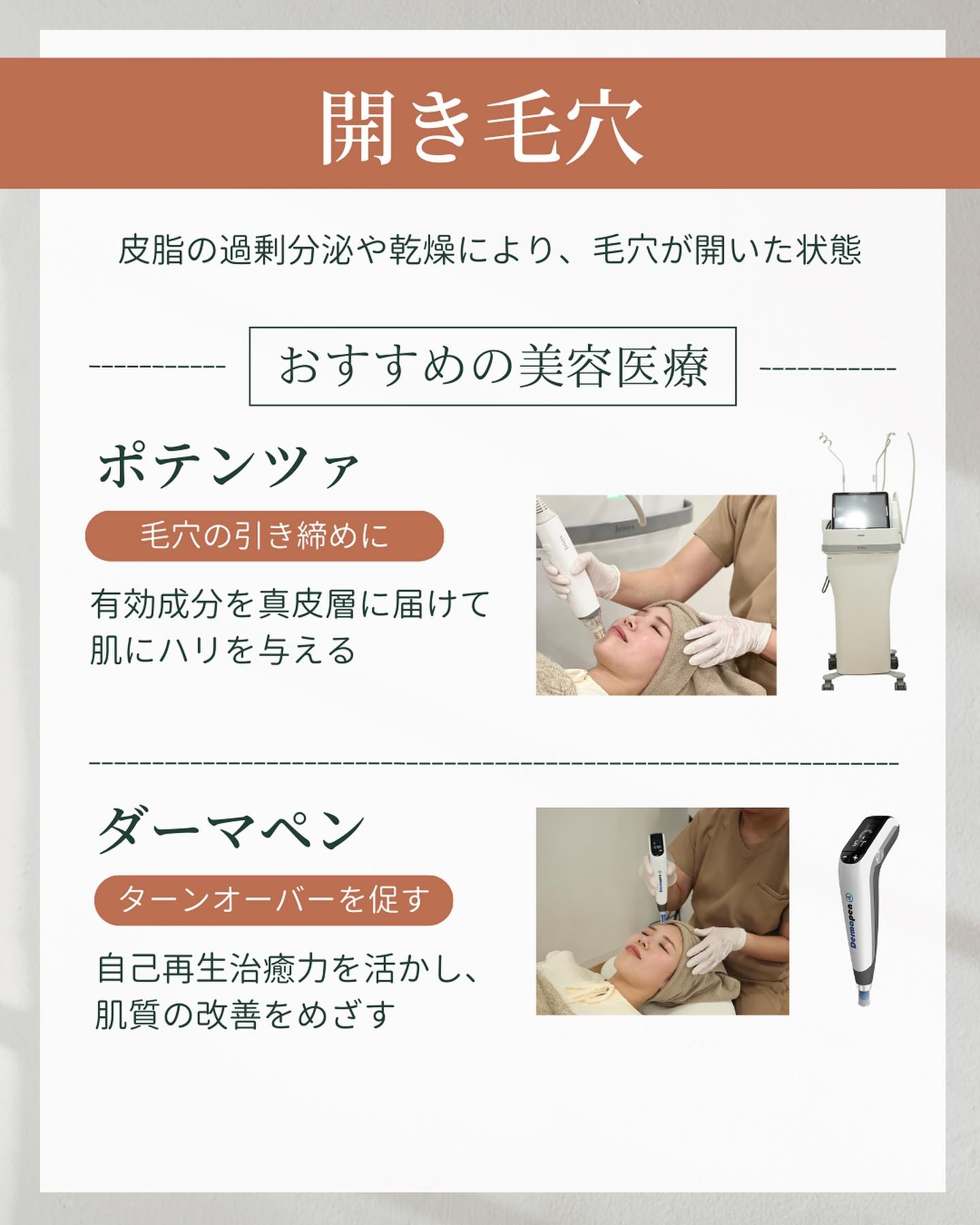 開き毛穴　治し方