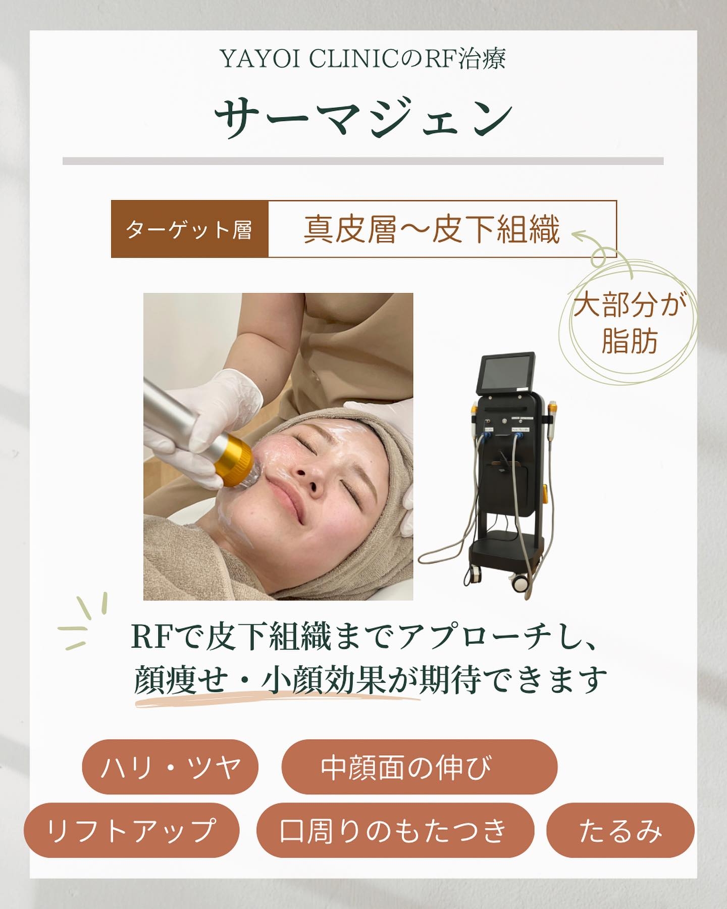 RF治療 サーマジェン