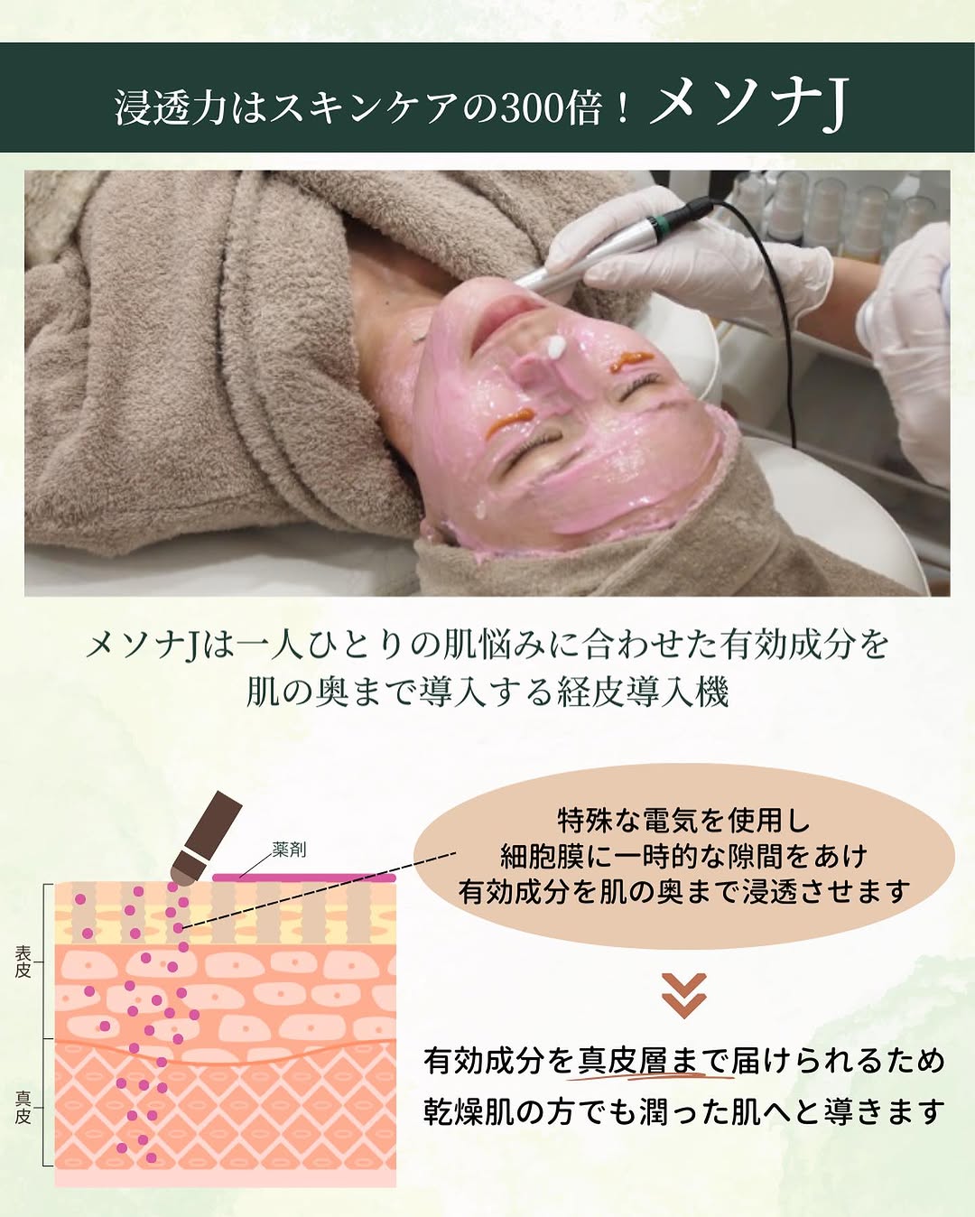 メソナJの施術で肌の奥（細胞間隙）まで有効成分を浸透させる仕組みを表した解説イラスト