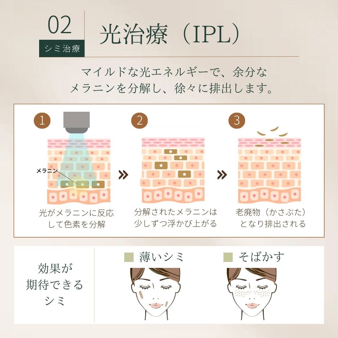 光治療（IPL）