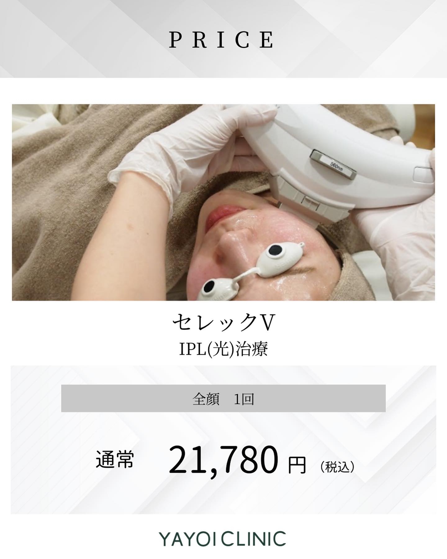 ヤヨイクリニックのセレックV｜料金