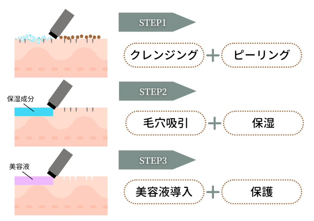 Getting a Hydrafacial in Hiroshima! Points to consider when choosing a clinic are explained.