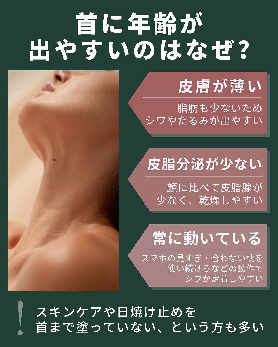 首に年齢が出やすいのはなぜ？