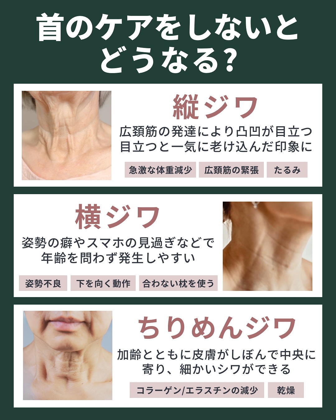 首のケアをしないとどうなる？