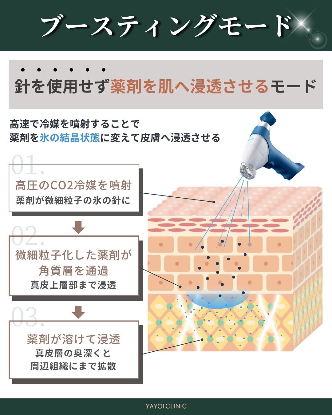 ターゲットクールとは？ブースティングモードについて解説
