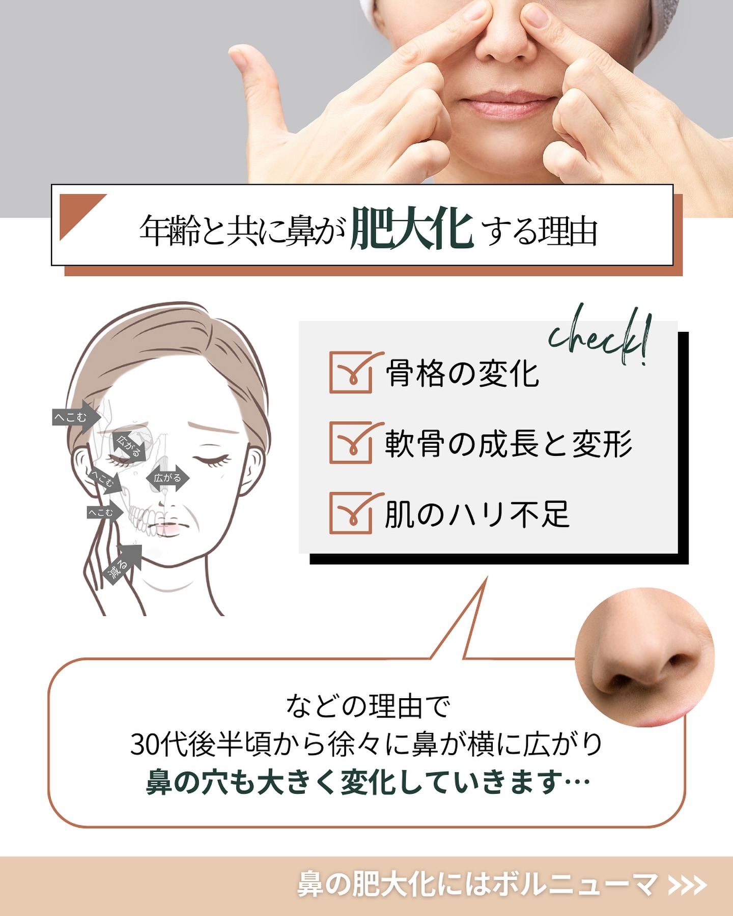 Why the nose becomes enlarged with age