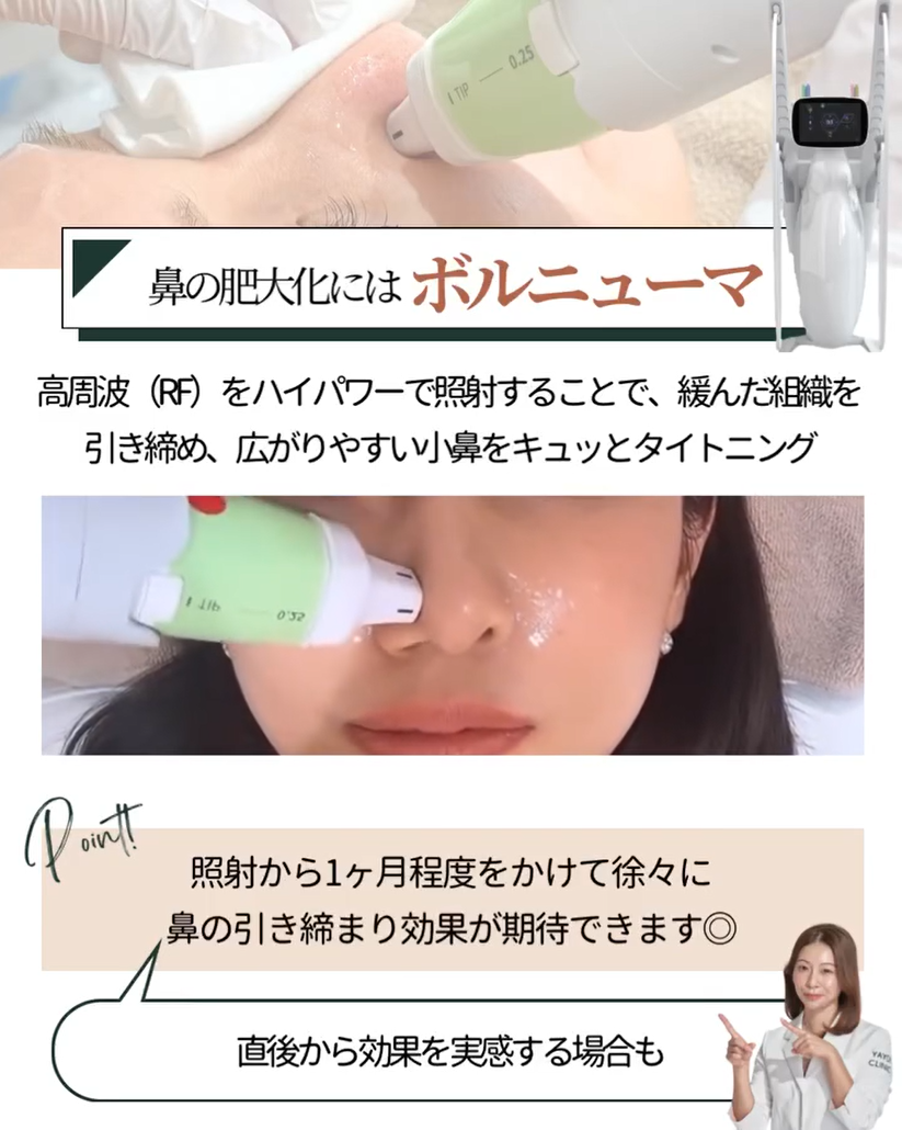 Volnuma is recommended for enlarged nose.