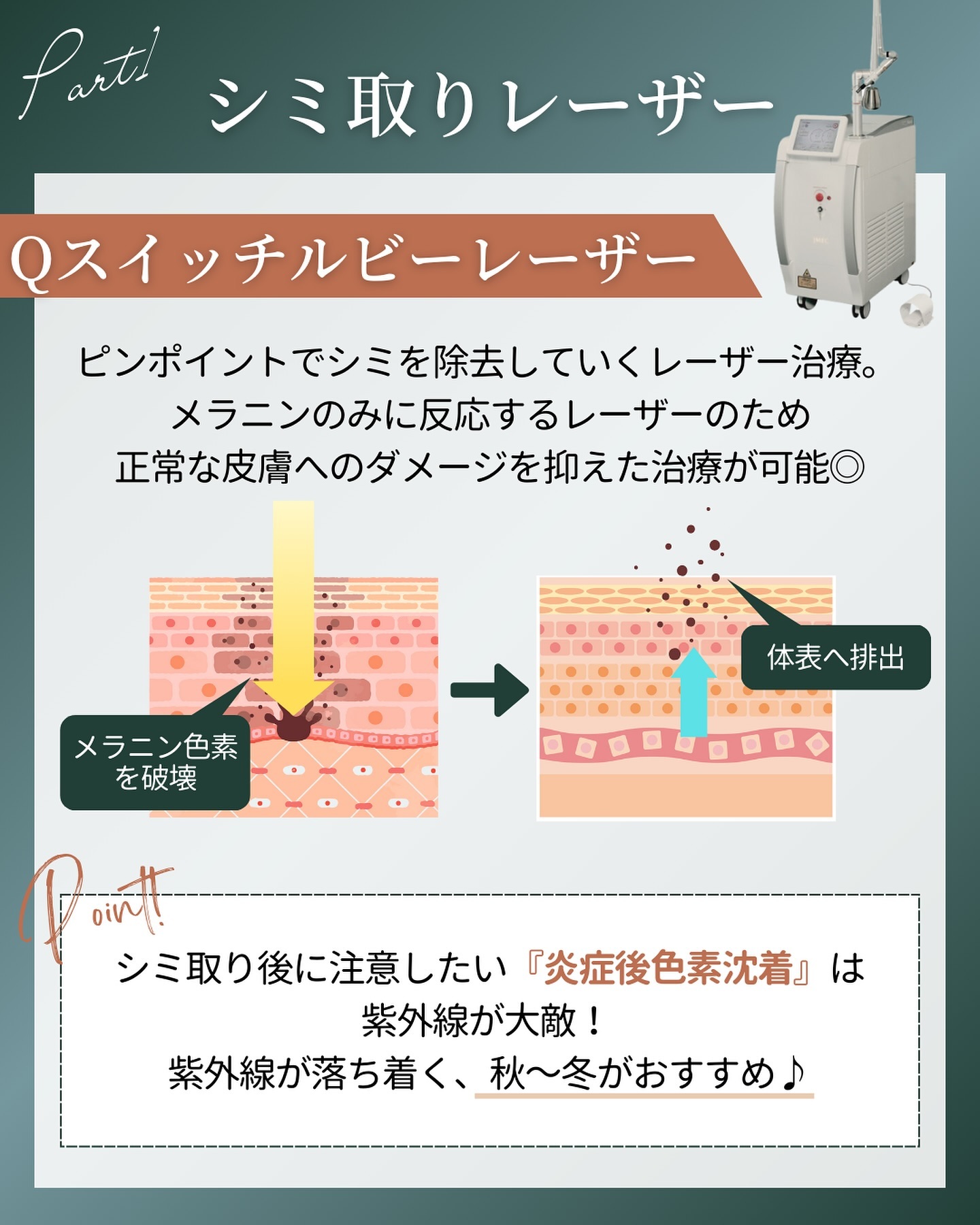 Qスイッチルビーレーザーによるシミ取り