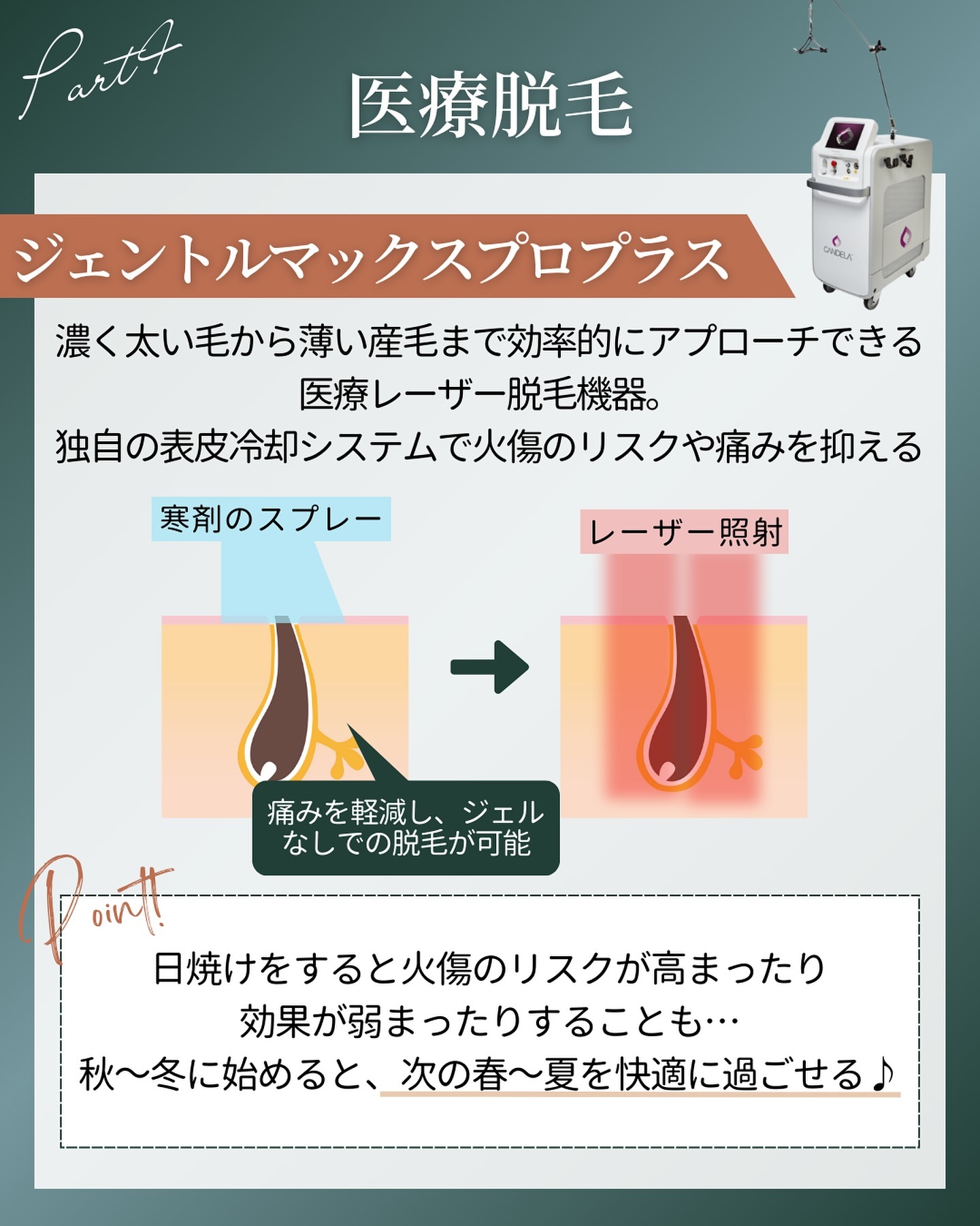 ジェントルマックスプロプラスで医療脱毛
