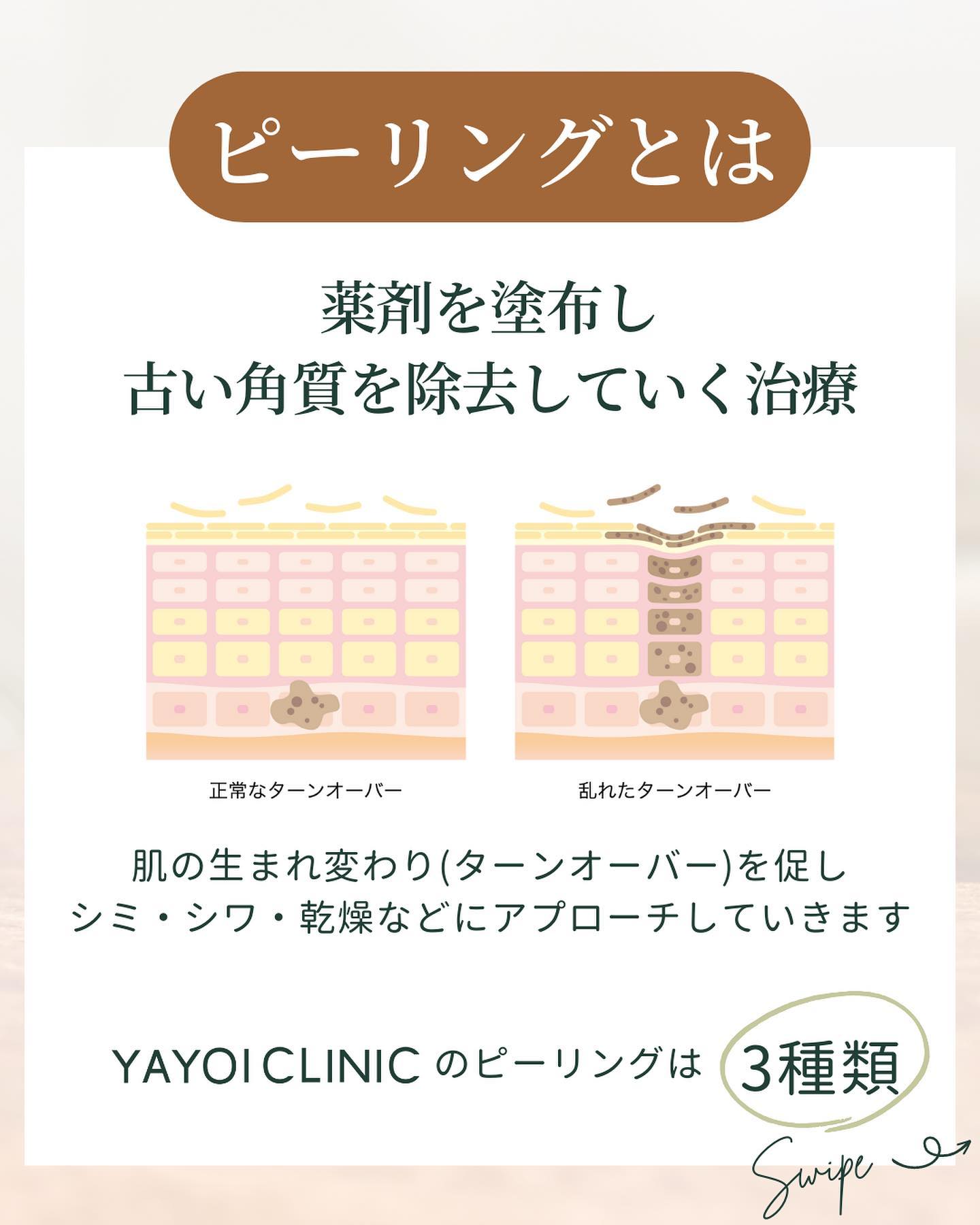 そもそもピーリングとはどんな施術?