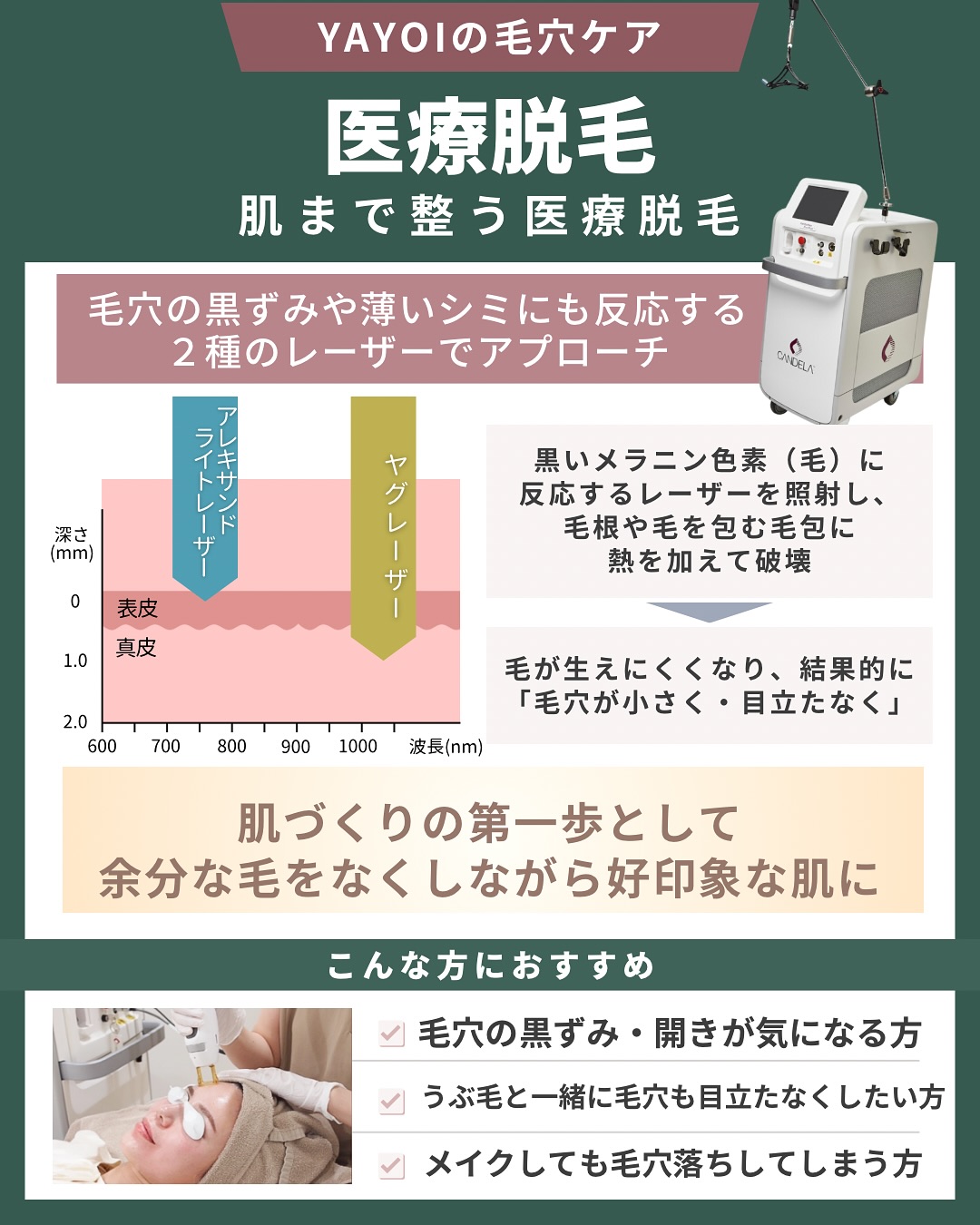 医療脱毛　ジェントルマックスプロプラス