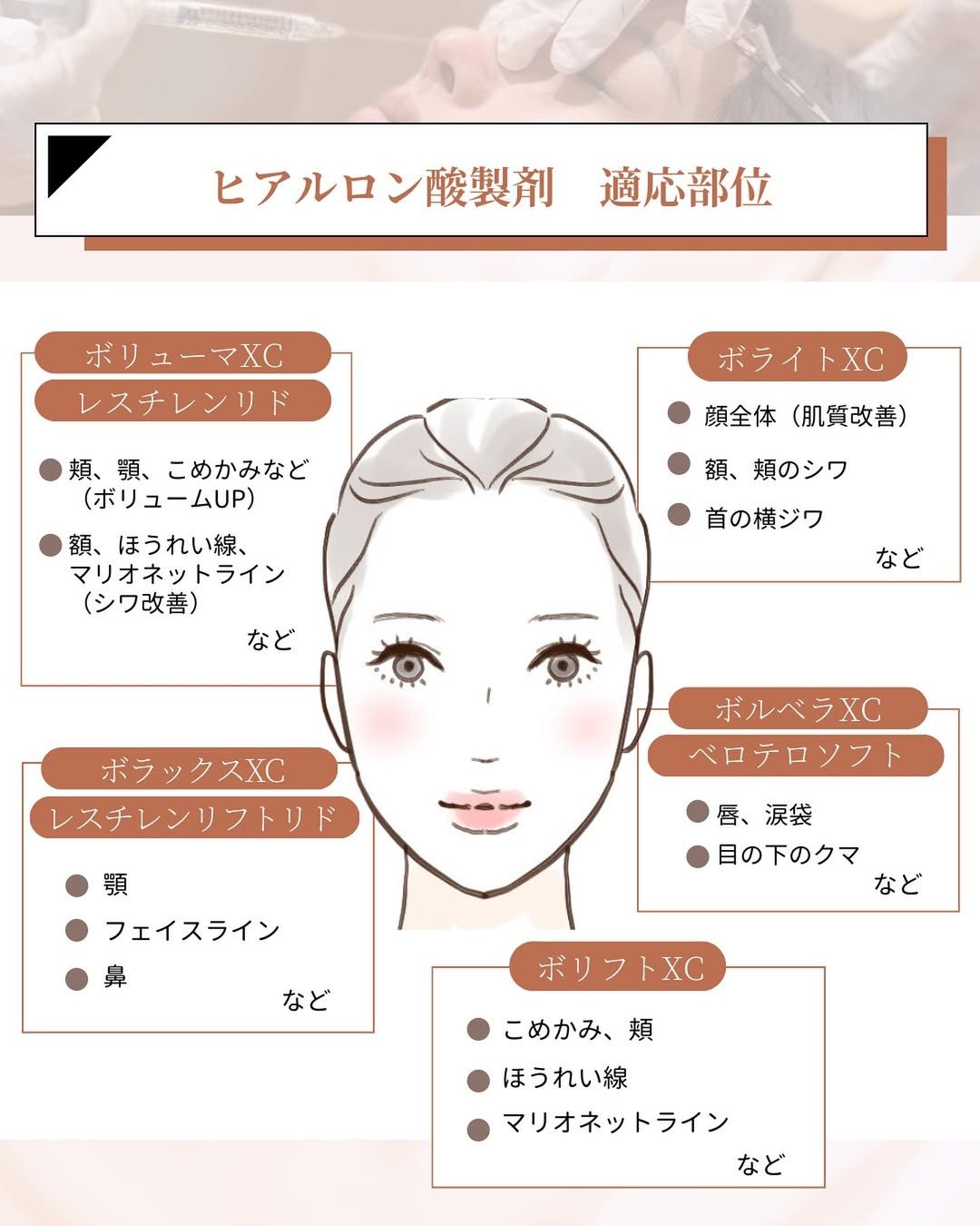 Hyaluronic Acid Preparation Indicated Areas