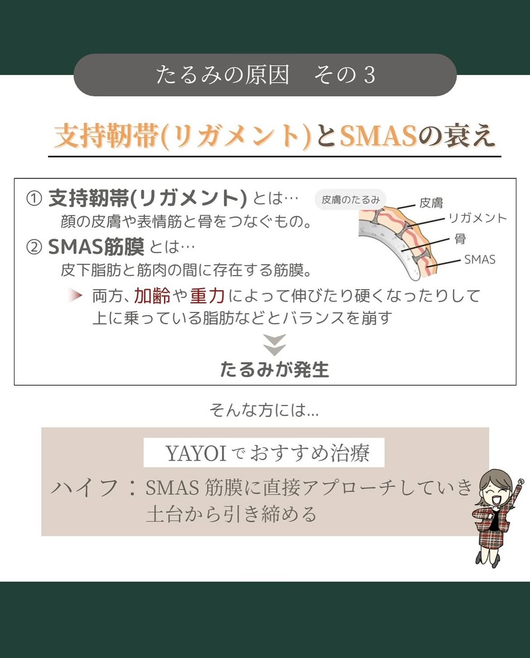 たるみの原因3つ目は支持靱帯（リガメント）やSMASの衰え