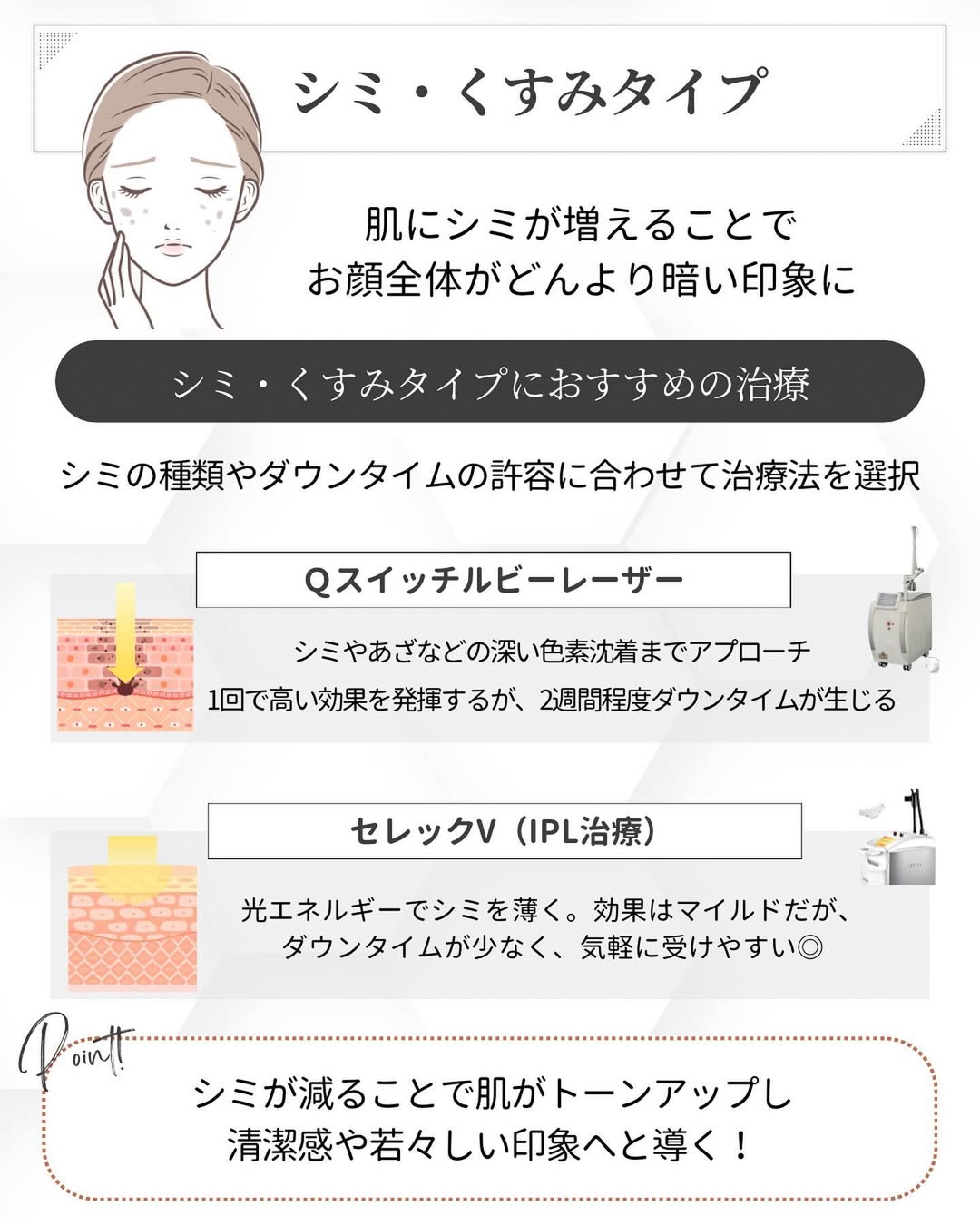 シミ・くすみタイプにおすすめの治療「Qスイッチルビーレーザー」、「セレックV（IPL治療）」