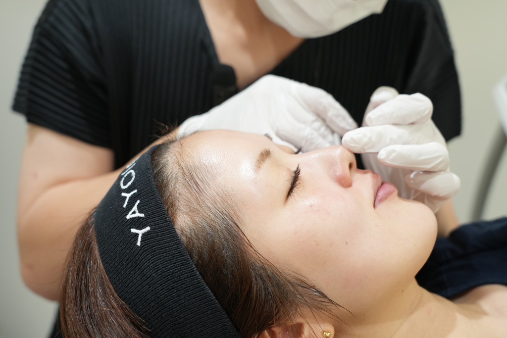 Botox for the Nostrils
