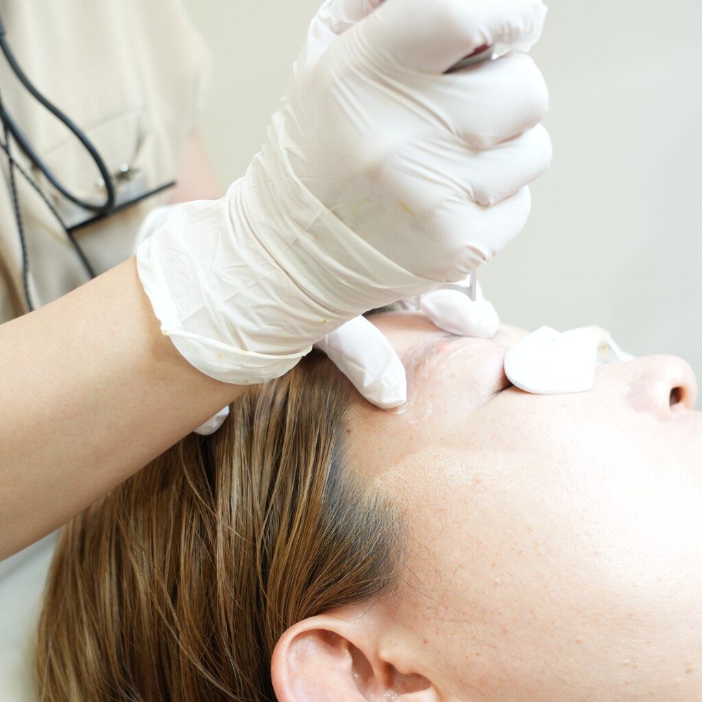 Permanent Makeup Laser Removal