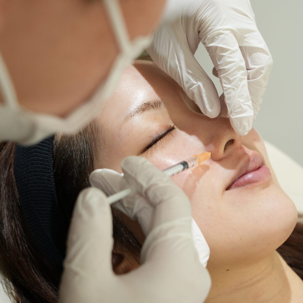 Botox for the Nostrils