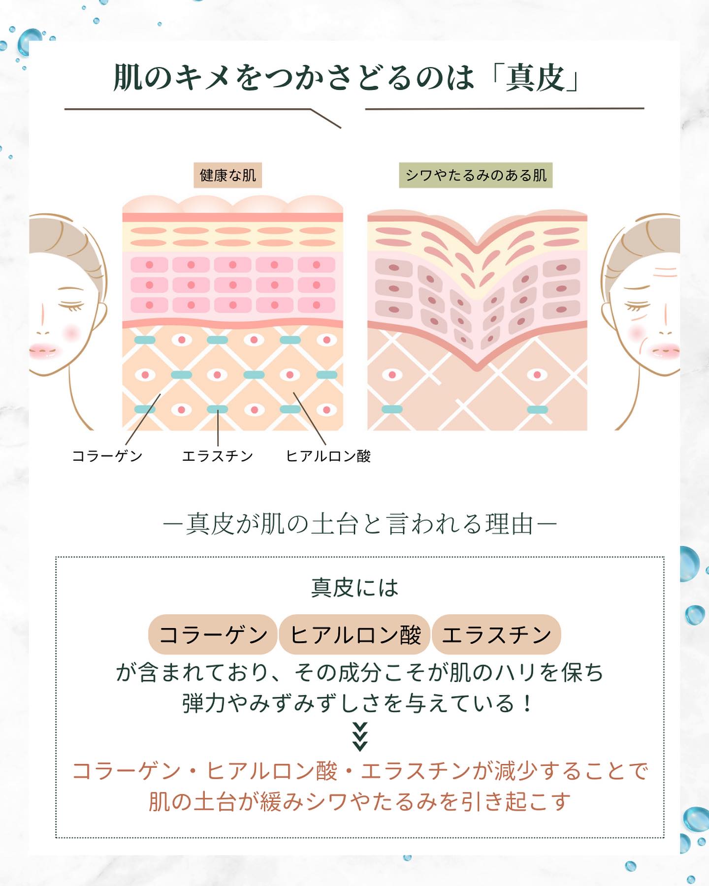真皮 シワ たるみ