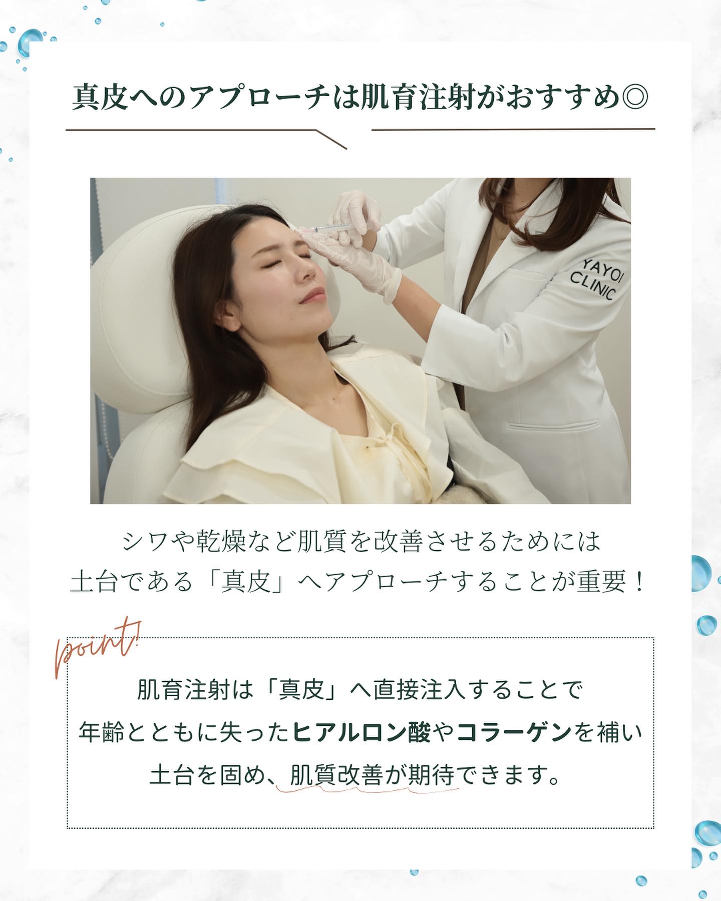真皮 肌育注射