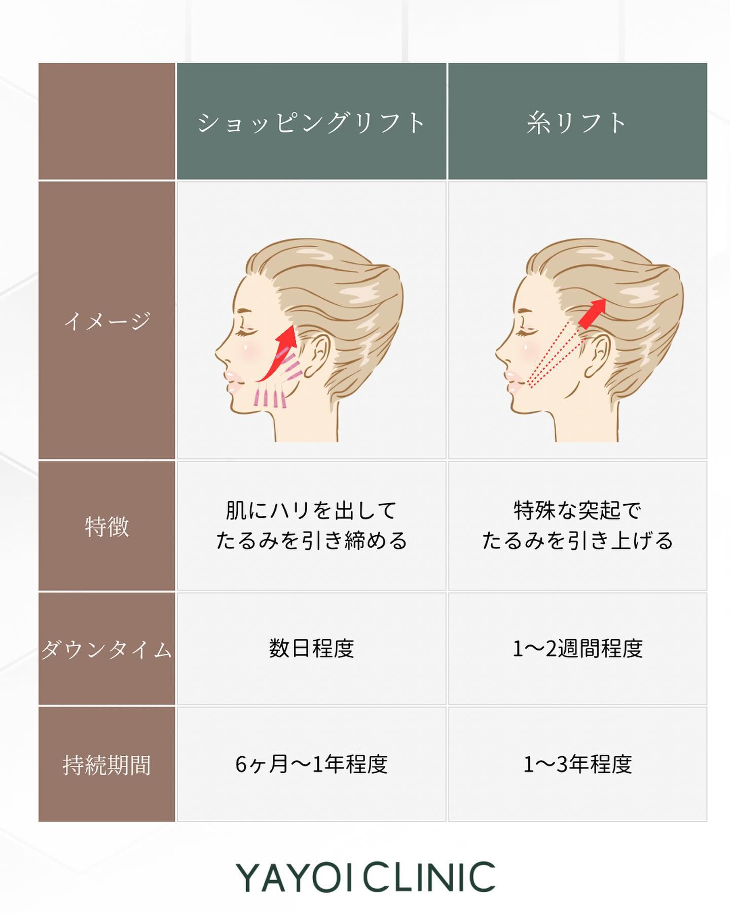 ショッピングリフト　糸リフト　違い