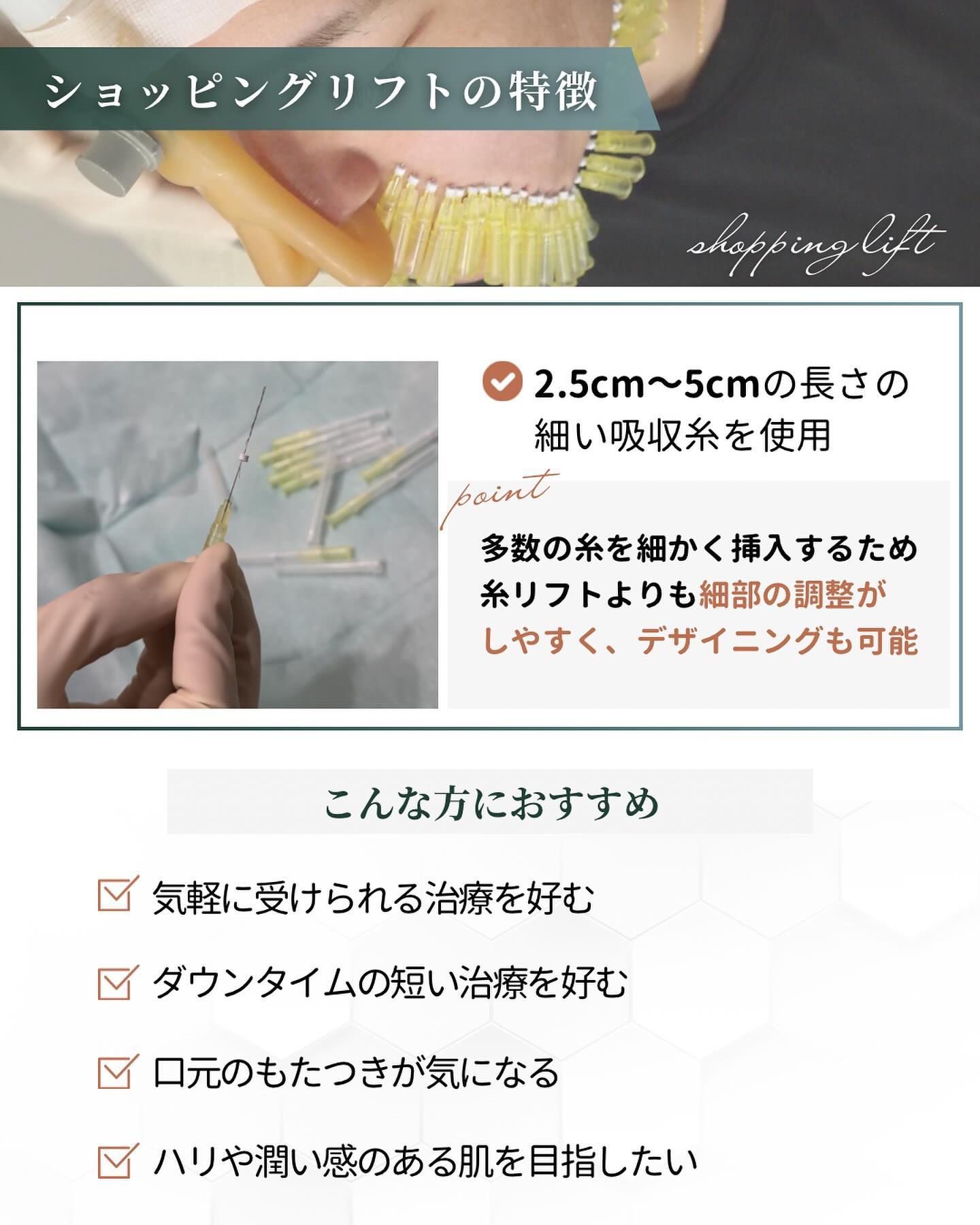 ショッピングリフト　特徴