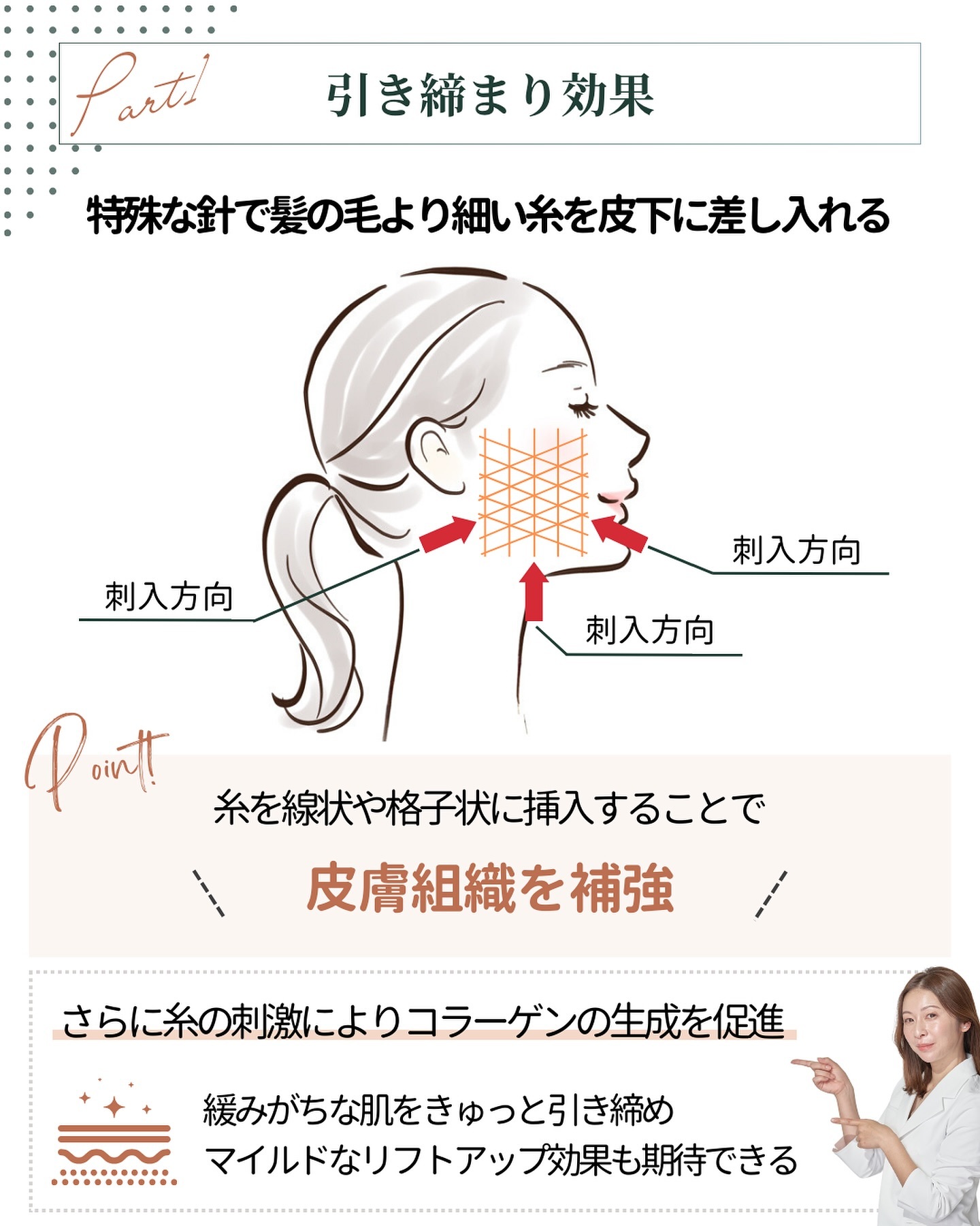 ショッピングリフト 魅力 引き締め