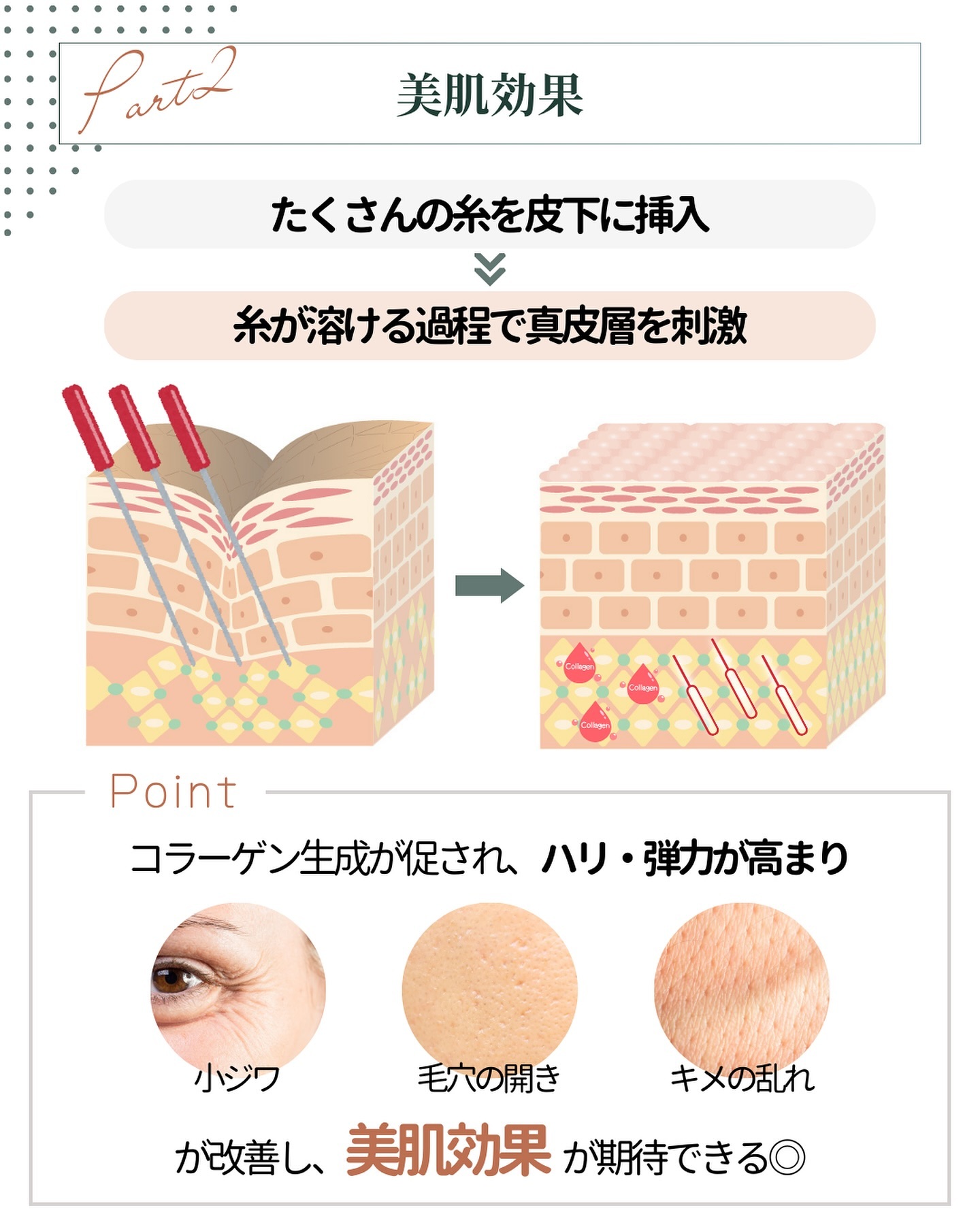 ショッピングリフト 魅力 美肌効果
