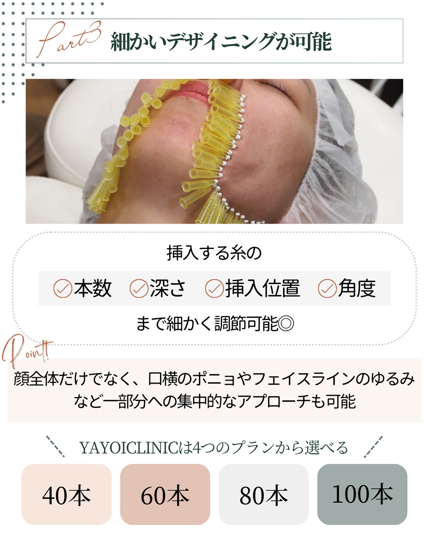 ショッピングリフト 魅力 デザイン