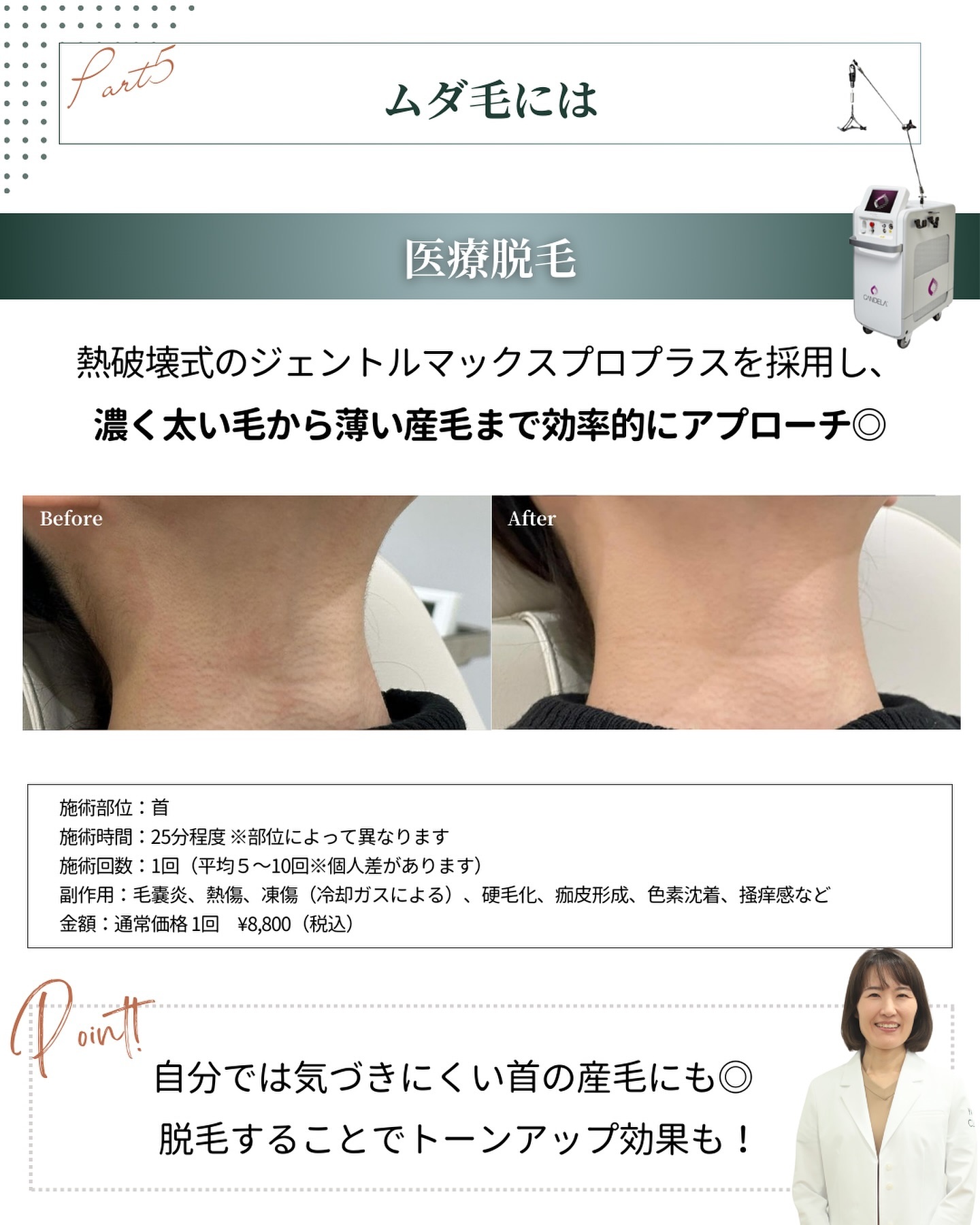 Laser Hair Removal