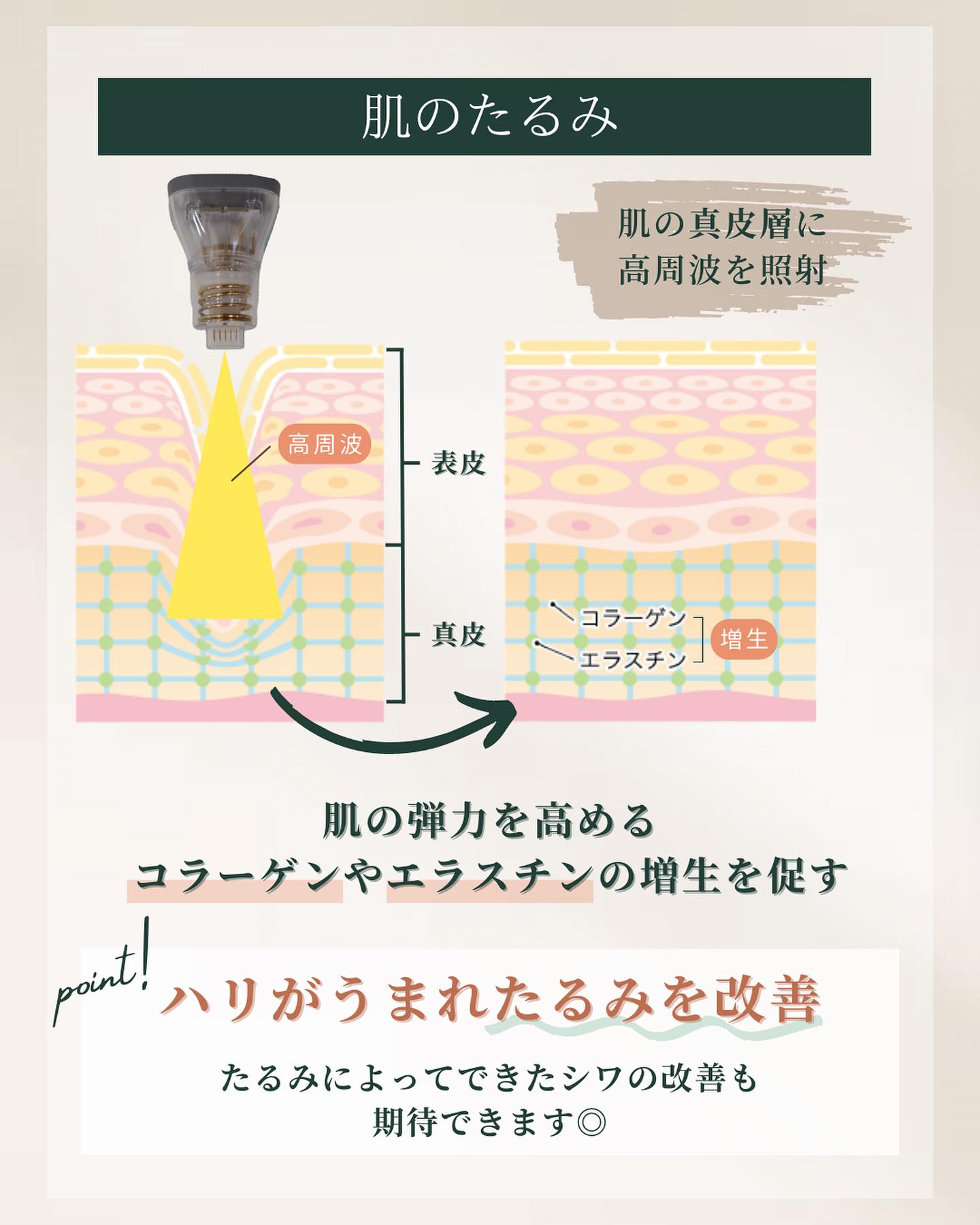 ポテンツァ　たるみ